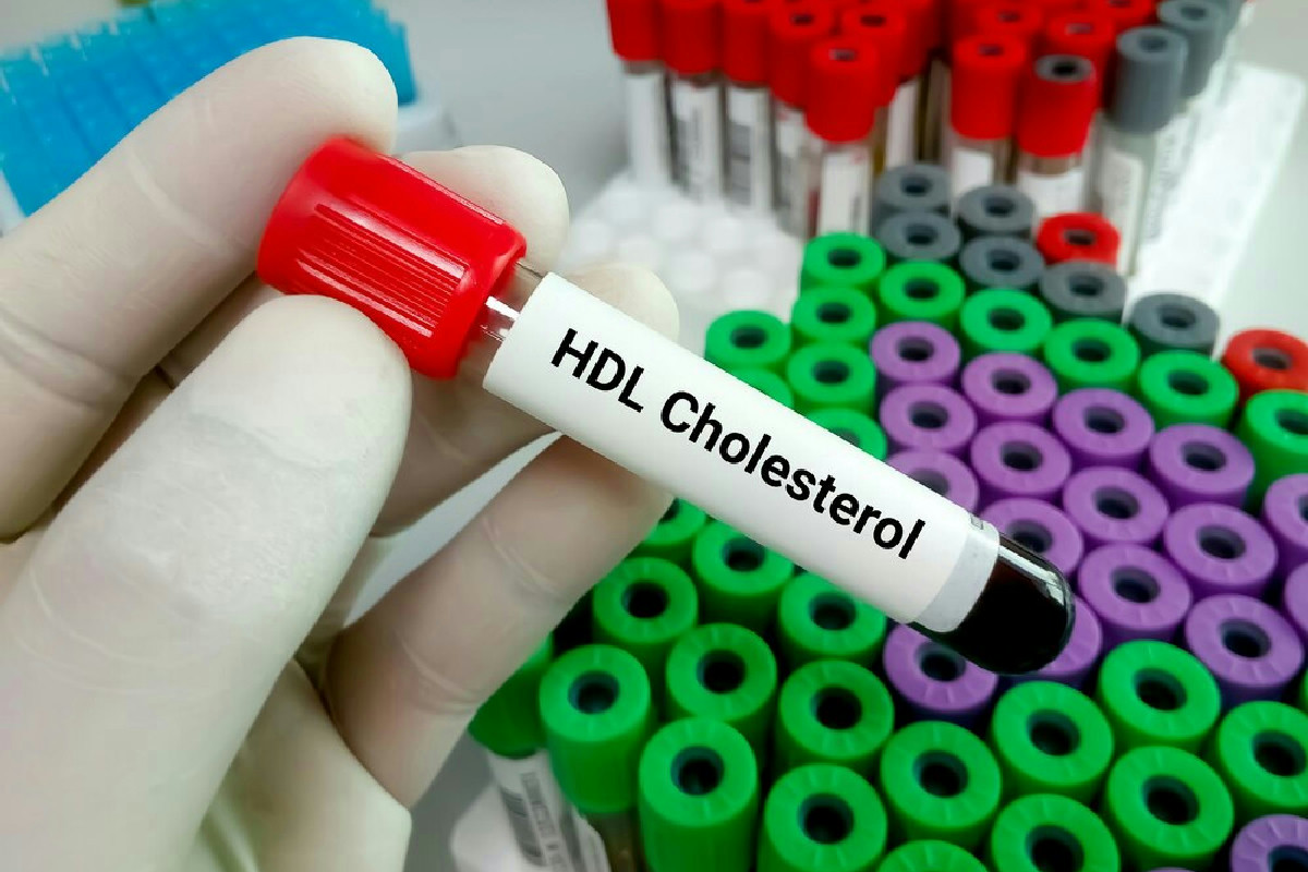 Non pensavo di avere il colesterolo LDL alto: ecco come ho iniziato a farlo scendere davvero